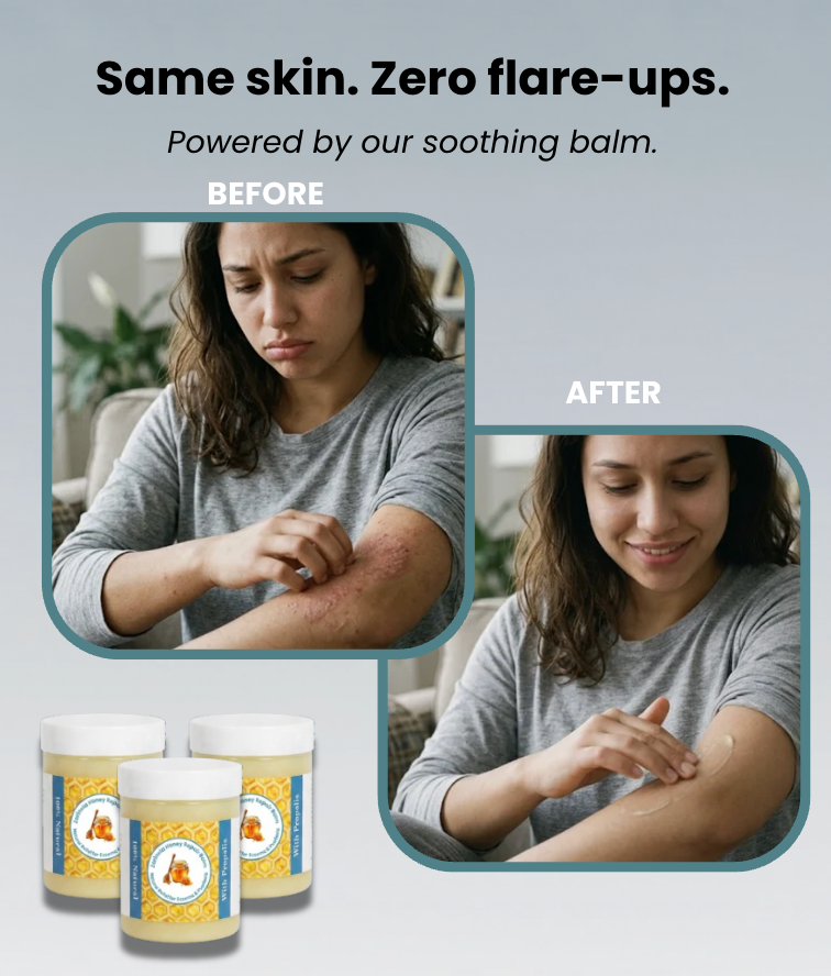 Honey Repair Balm - Natural Relief for Eczema & Psoriasis